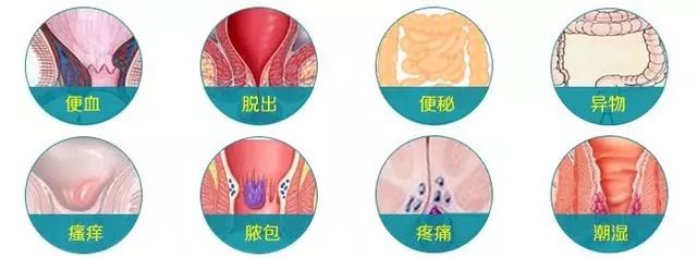 便血并非上火，恐是直肠“亮红灯”